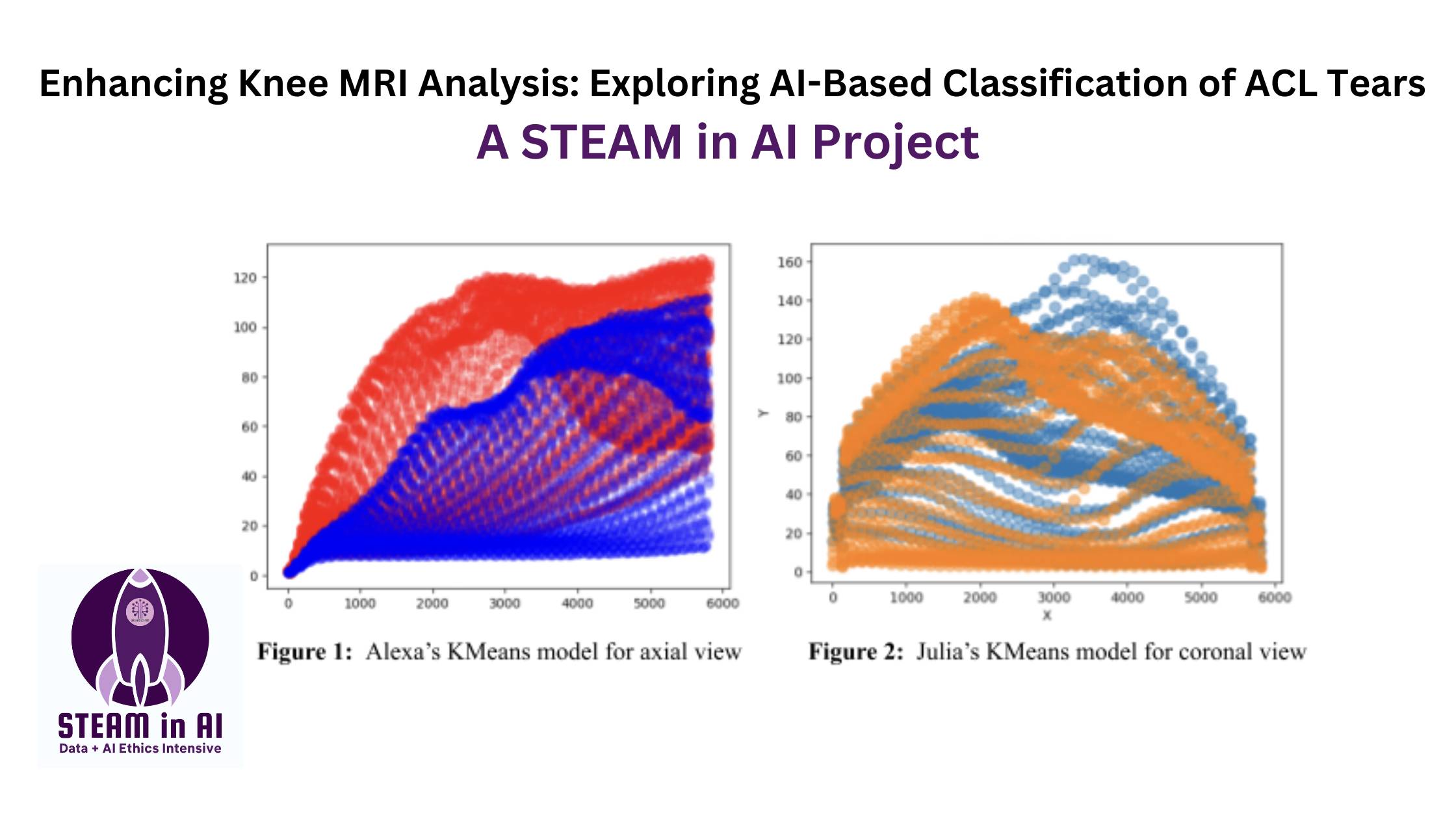STEAM in AI Research_Exploring AI-Based Classification of ACL Tears